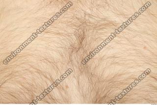 human skin hairy 0015